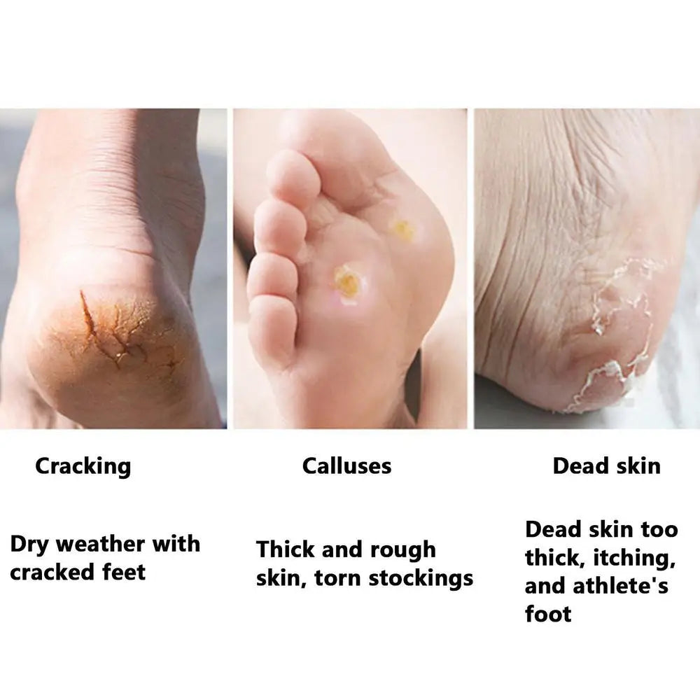 Foot Scraper For Callus Removal Foot Scrub Brush Double-sided Heel Grinder Pedicure Foot File Cuticle Cleaner Remove Dead Skin